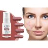 Leke Karşıtı Krem 15 Spf